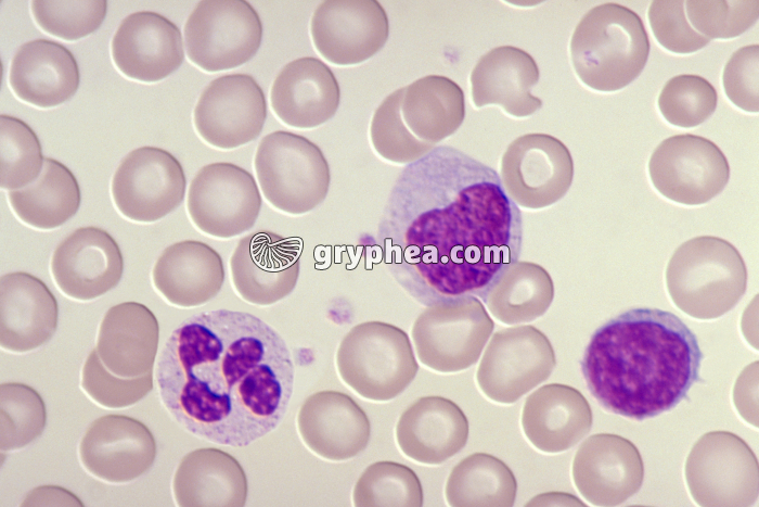 Leucocytes x400 - gryphea.org